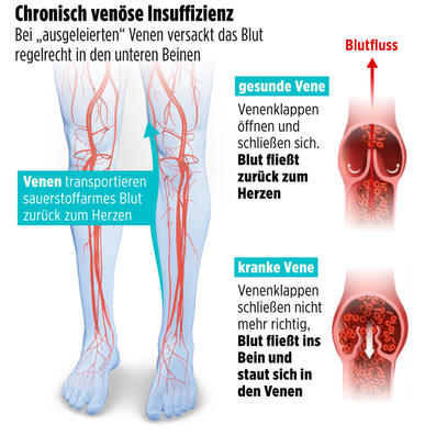 infografik impasto tom kretschmer trump venen 01tk.jpg